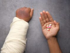 la polyarthrite rhumatoïde: symptômes, causes , diagnostic et traitement