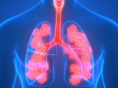 Drainage postural: cela fonctionne-t-il vraiment?