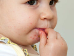 Ce qu’il faut savoir sur la fièvre aphteuse