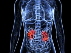 Cancer du rein (rénal) : introduction