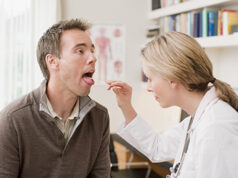 Cancer oropharyngé | Médecine Johns Hopkins