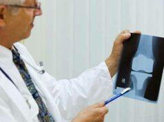 Procédure de chirurgie de remplacement du genou | Médecine Johns Hopkins