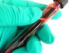 VIH-1 vs VIH-2 : Différences et similitudes