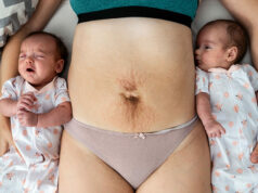 Douleur à la hanche post-partum : causes, symptômes, diagnostic et traitement