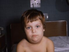 Oreillons enfant avec oreillons