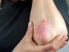 le stress : 10 choses étranges pour votre corps