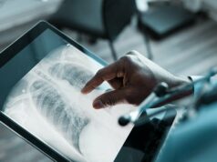 Lymphome pulmonaire du MALT : symptômes, traitement, perspectives