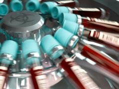 Test génétique cancer : 10 choses essentielles à savoir pour comprendre les risques test génétique cancer